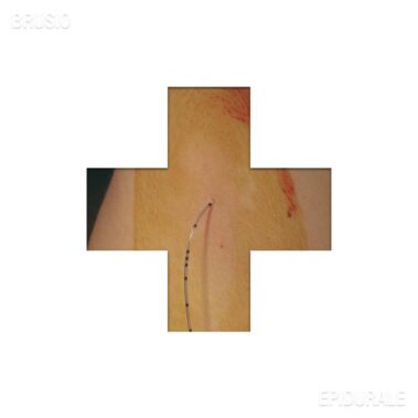 Brusio - Epidurale - Musica Pop