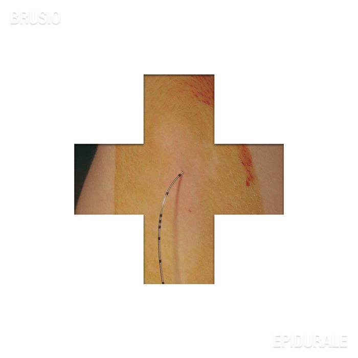 - Brusio - Epidurale